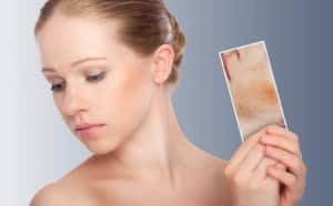 meditation et eczema