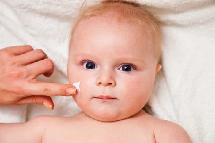 eczema bébé