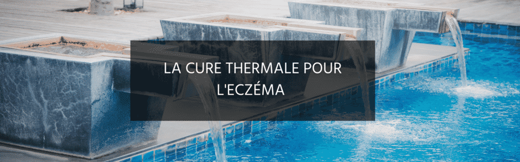 La cure thermale est-elle efficace contre l’eczéma ?