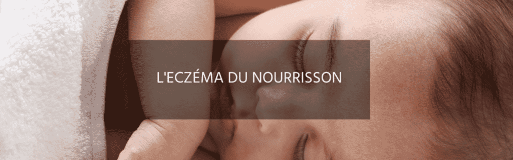 Eczéma du nourrisson : faut-il envisager des alternatives naturelles ?