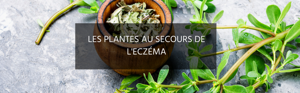 4 plantes à utiliser comme remède en cas d’eczéma