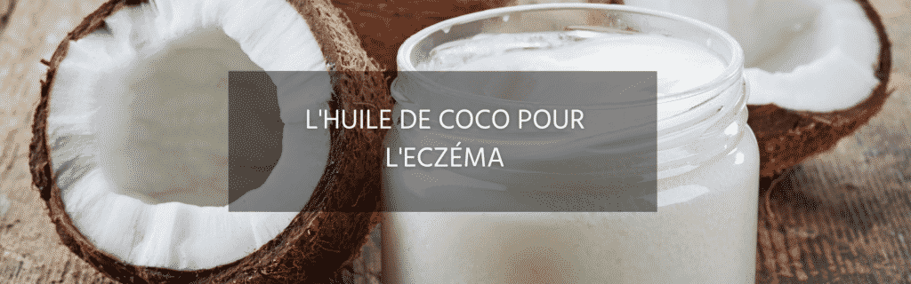 6 raisons d’utiliser l’huile de coco comme remède naturel contre l’eczéma
