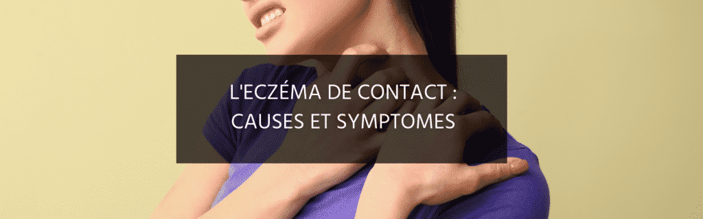Eczéma de contact : Comprendre cette dermatite pour mieux la traiter