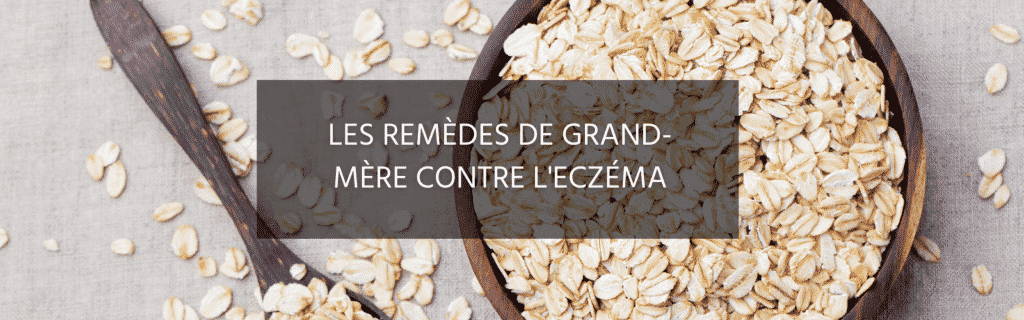 Quel remède de grand-mère utiliser contre l’eczéma ?