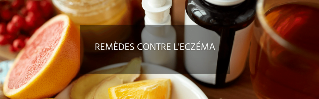 Voici 5 idées de remèdes pour se débarrasser de votre eczéma
