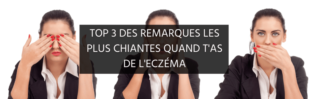 Top 3 des remarques les plus chiantes quand t’as de l’eczéma