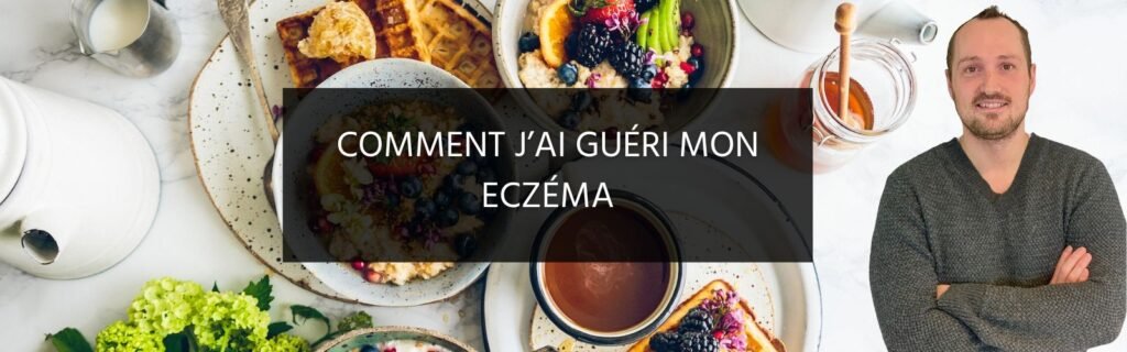 Comment j’ai guéri mon eczéma
