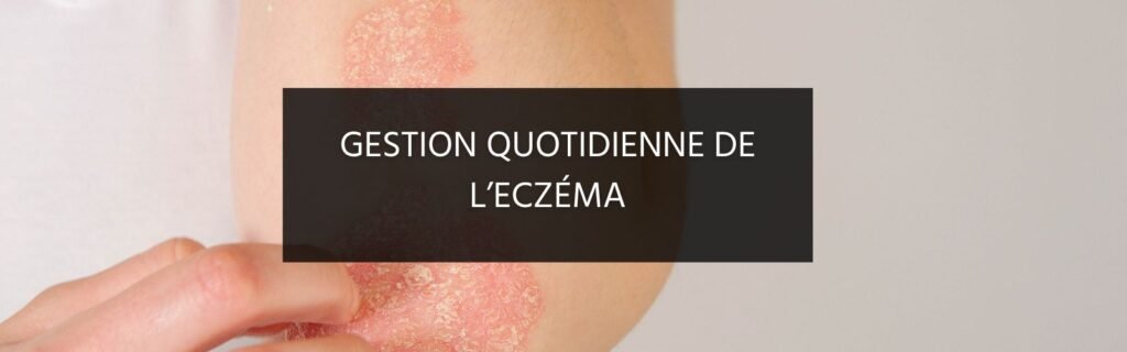Gestion quotidienne de l’eczéma : conseils pratiques pour réduire les poussées