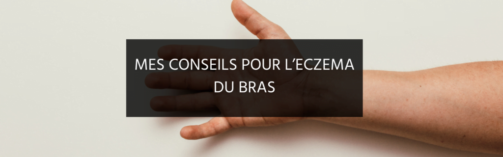 Mes conseils pour l’eczéma du bras