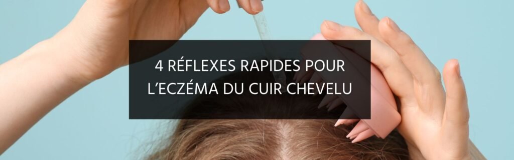 4 réflexes rapides pour soulager l’eczéma du cuir chevelu