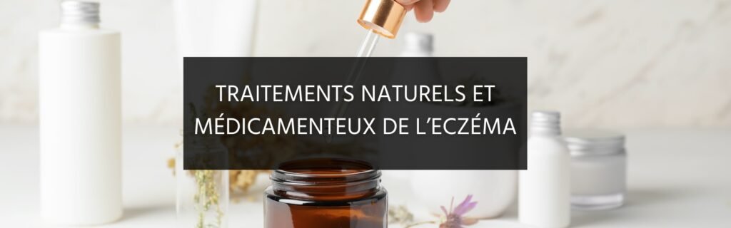 Quels traitements pour l’eczéma ?