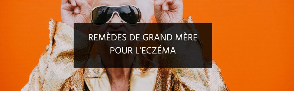 19 remèdes de grand-mère contre l’eczéma