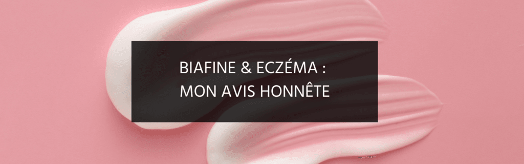 Mon avis honnête sur la biafine pour l’eczéma